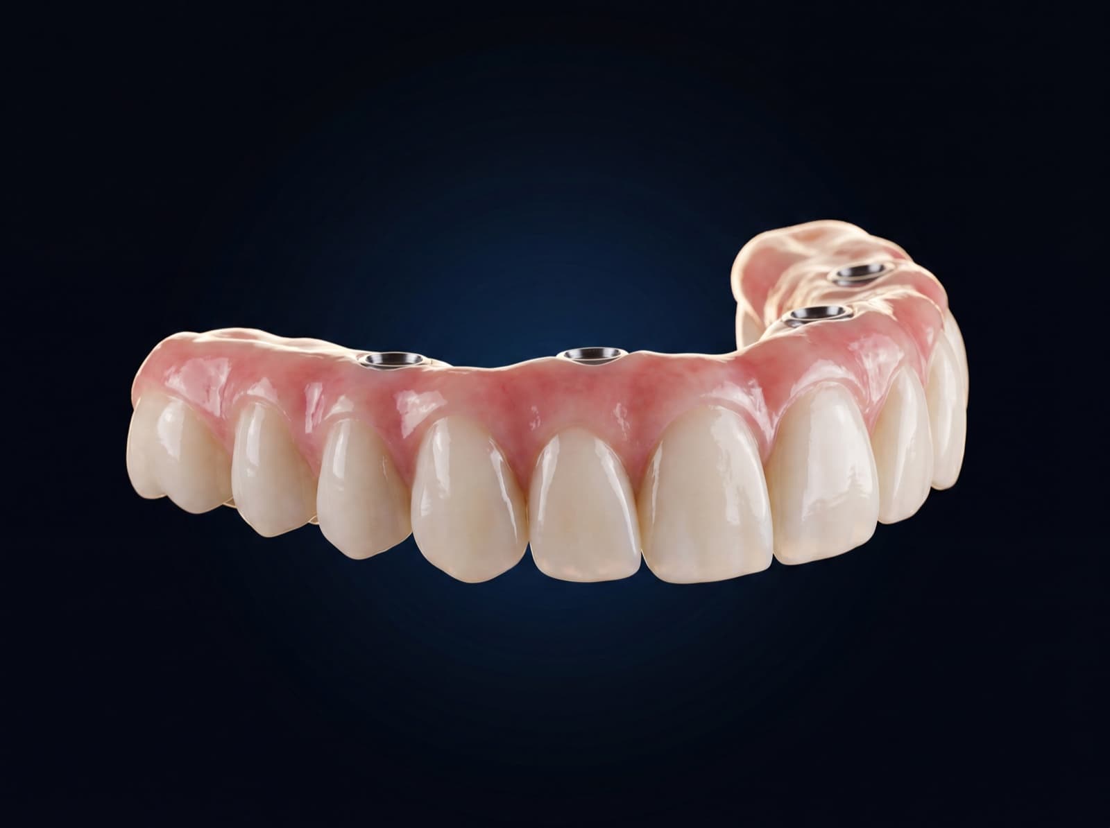 FP-3 — Vainikai + dantenos + kaulas